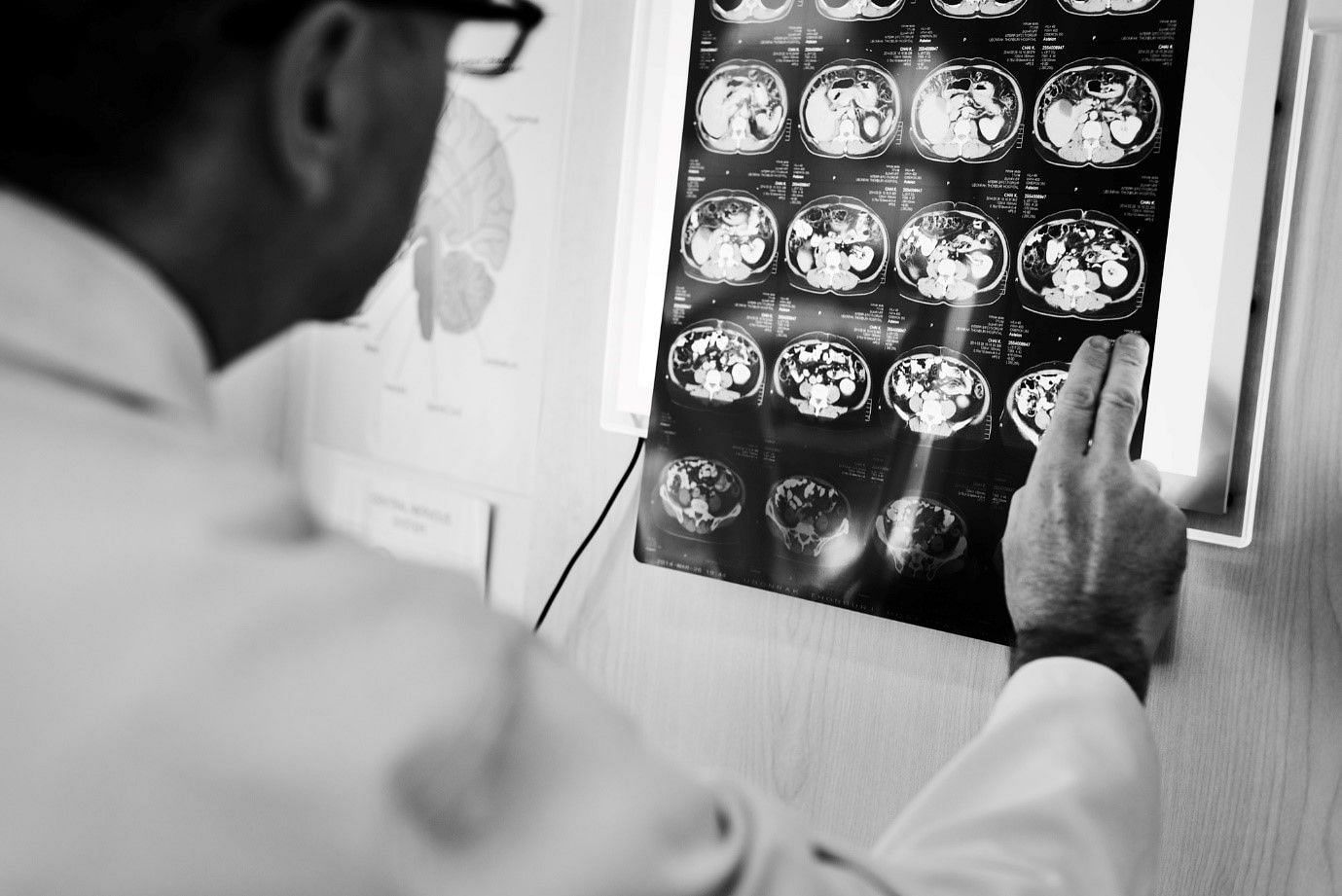 While childhood concussions tend to leave no major impacts, adulthood concussions can be very significant reasons for cognitive health decline later in life (Image by Rawpixel.com on Freepik)